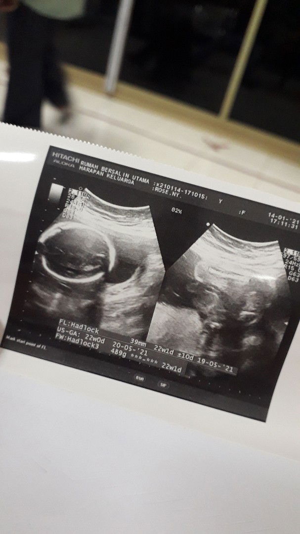 Oche Andriiani profile icon