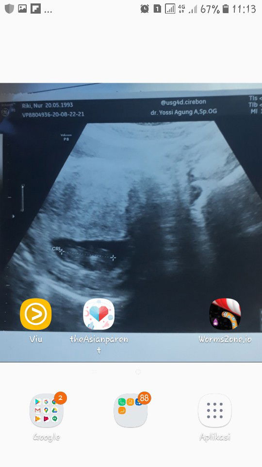 nur riki profile icon