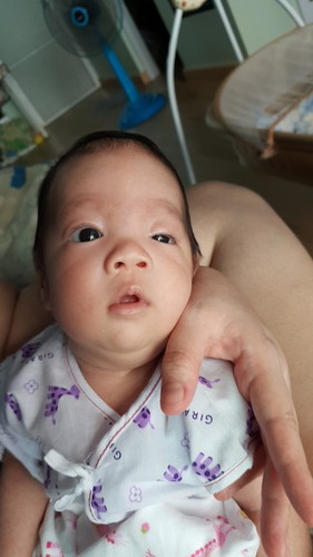 อยากถามแม่ๆที่ลูกมีปัญหาหนังตาตก