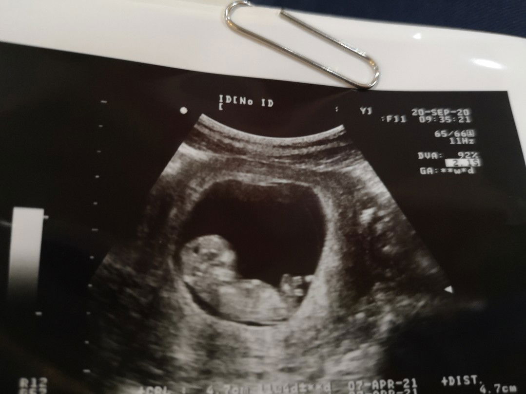 Supavadee Pongsomboon profile icon