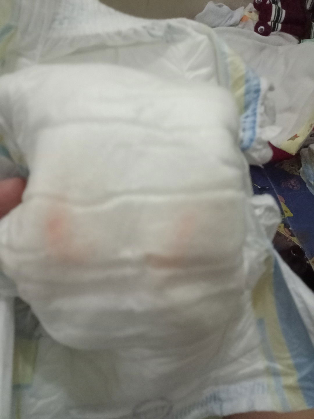 Blood sa ihi ni baby 2 months old normal Lang ba?