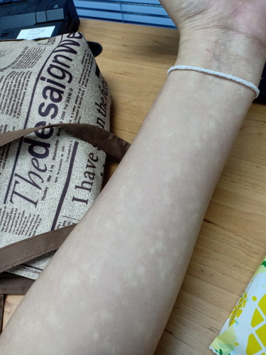 มีแม่ๆคนไหนเคยเป็นแบบนี้บ้างมั้ยคะ