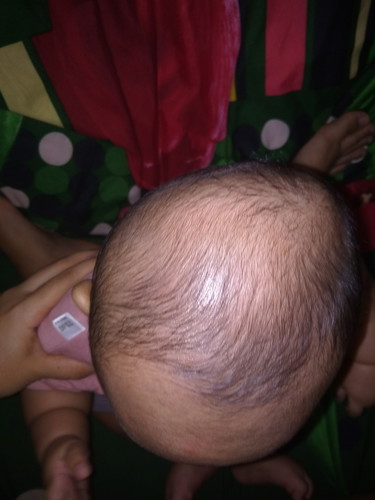 kepala bayi peang