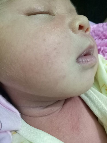 kulit bayi