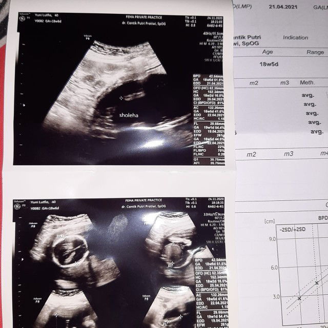 Aisha Mikayla Syabina profile icon