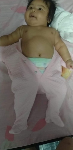 Normal ba tummy ni baby ko?