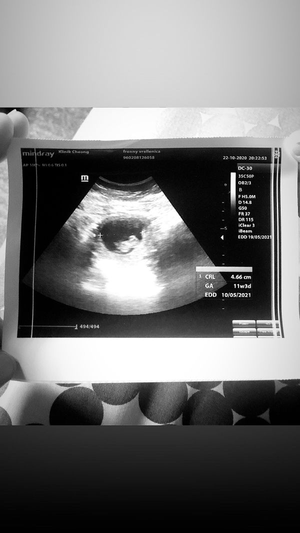 Elvie14 profile icon