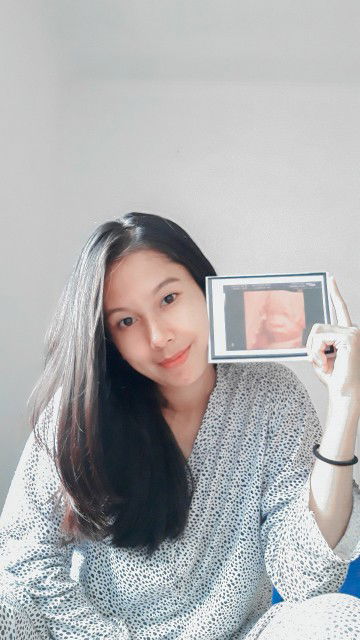 Millie Febrina profile icon