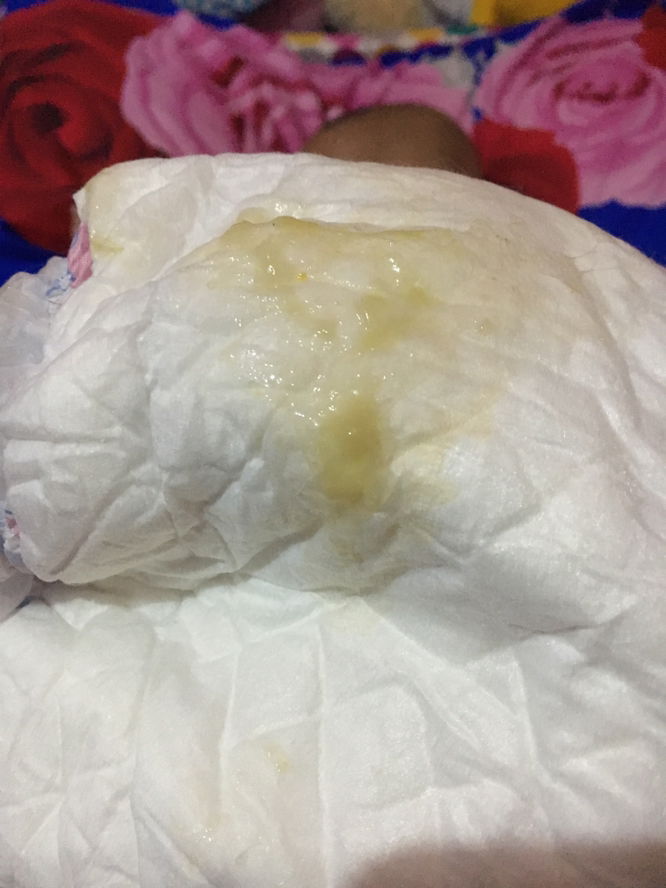 Warna pup bayi putih