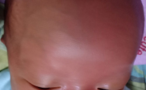 urat urat di kepala bayi