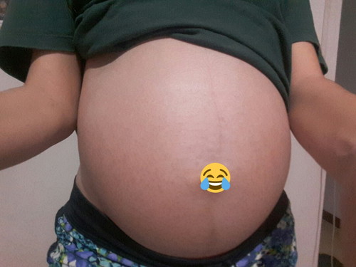 8เดือนแล้วค่ะท้องเล็กไปมั้ย ?