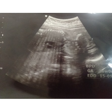 ช่วยหน่อยค่าาา ไปซาวด์ดูเพศมาวันนี้ ดูไม่เป็นค่ะ 6เดือนแร้ววว