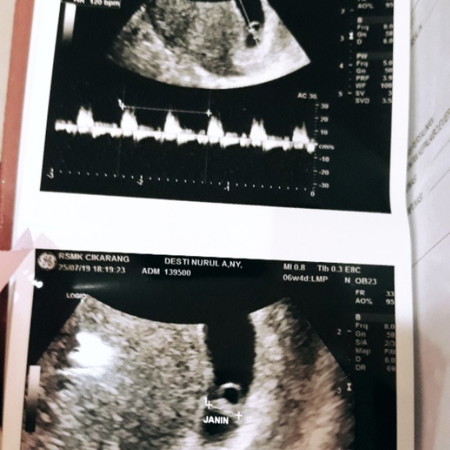 6w4d