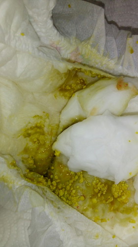 แพ้นมผสม