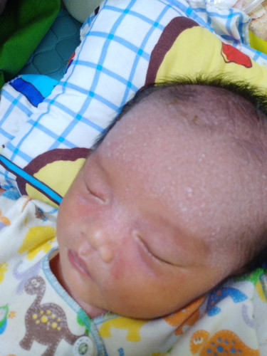 bintik putih seperti ada air