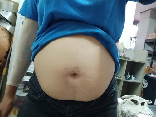 เพศลูก