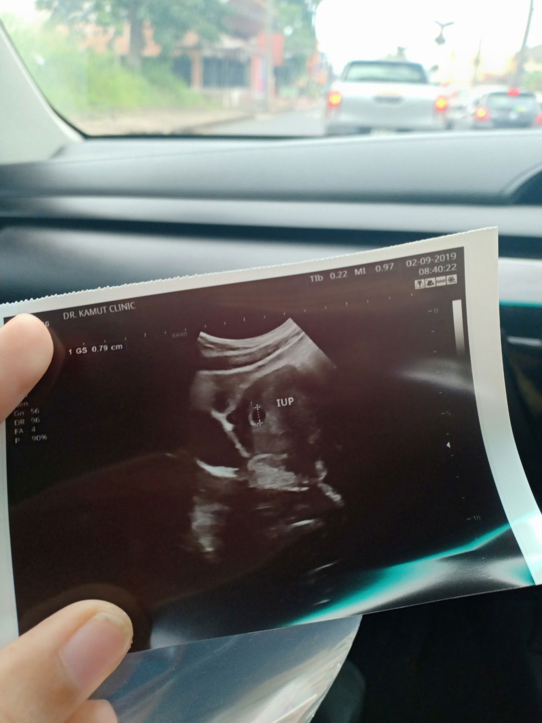 สอบถามคุณแม่ค่ะ