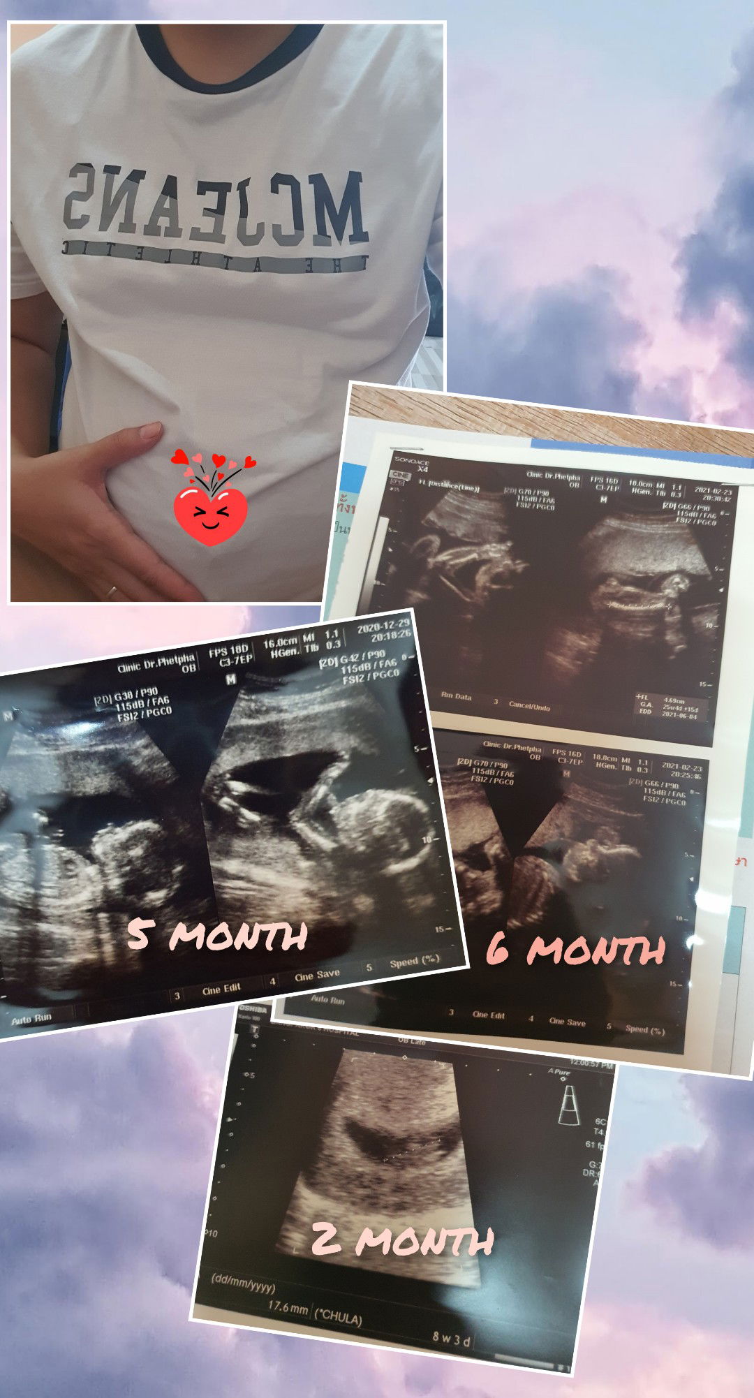 Kanapat S profile icon