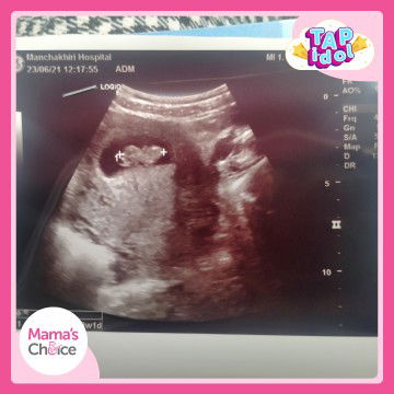 สายฝน ก้านขวา profile icon