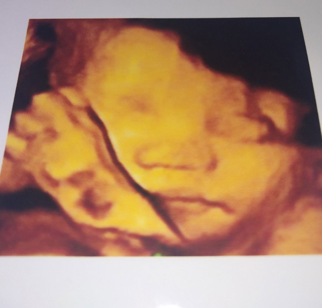 Mẹ Hấu profile icon