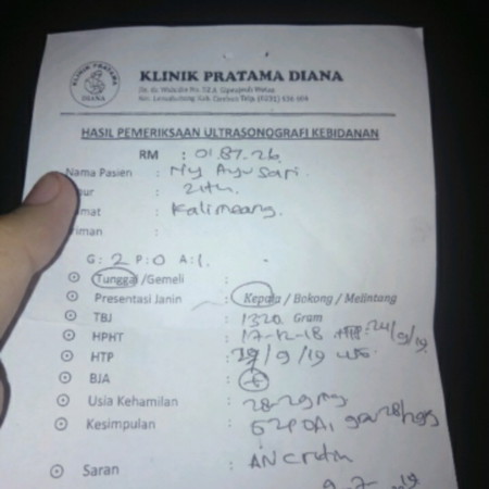 bingung