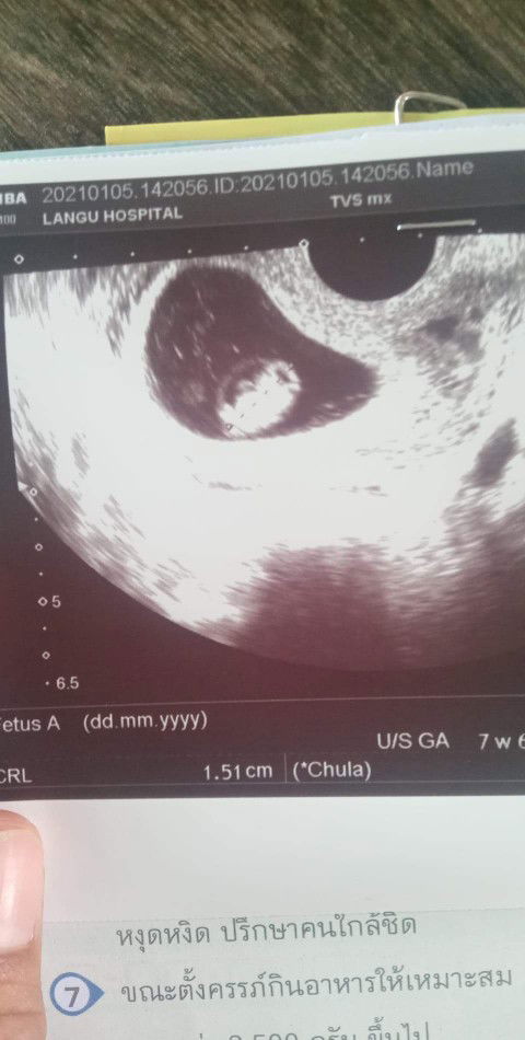 เเม่นก?? profile icon