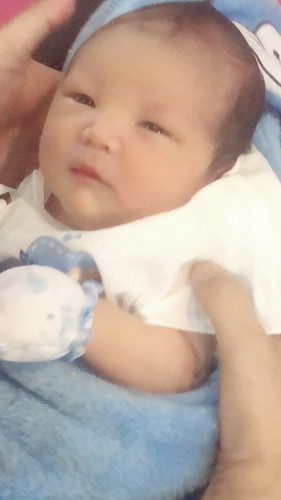 หัวลูกไม่ลงเชิงกราน???