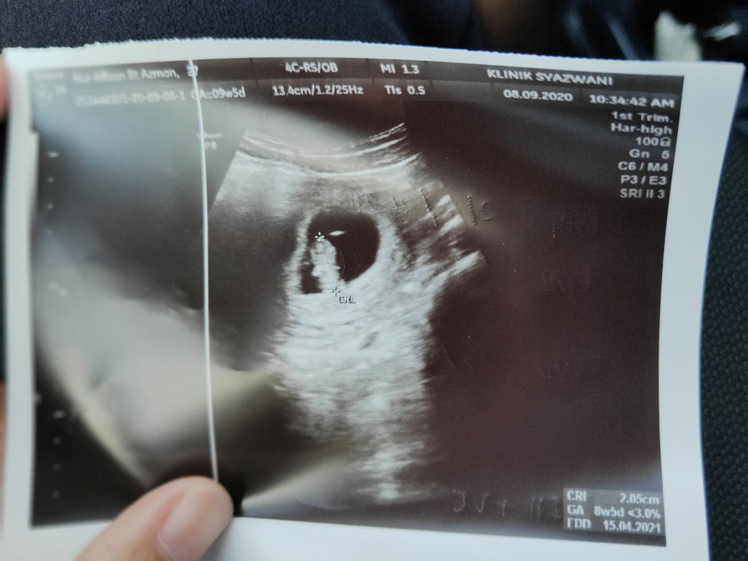 Affzan Azman profile icon