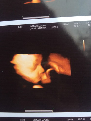 เบาๆนะแม่