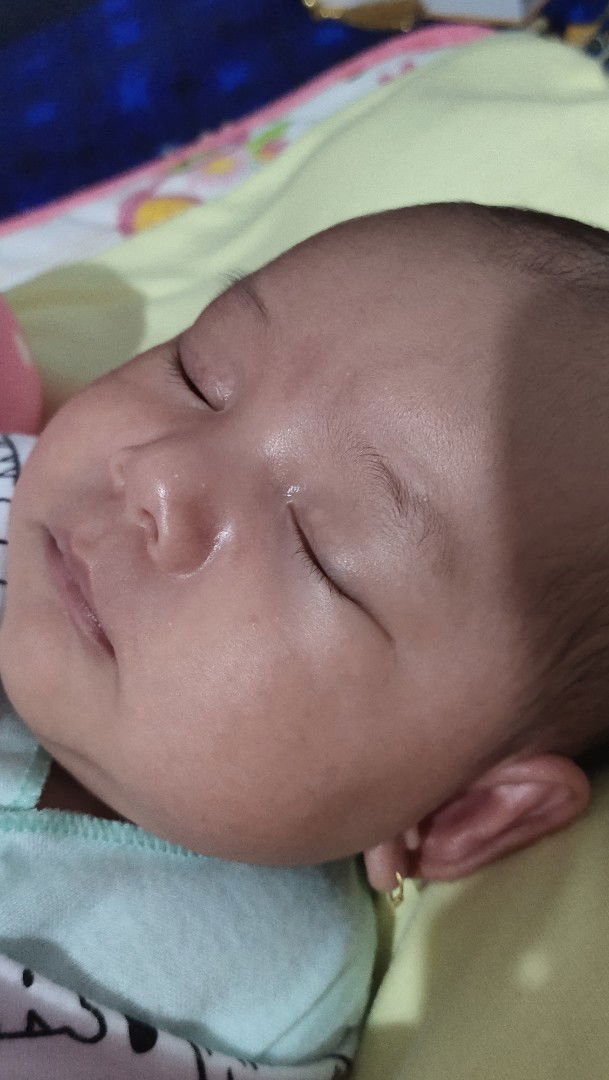 Bintik² putih pada wajah bayi