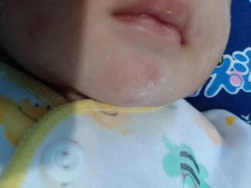bibir bayi