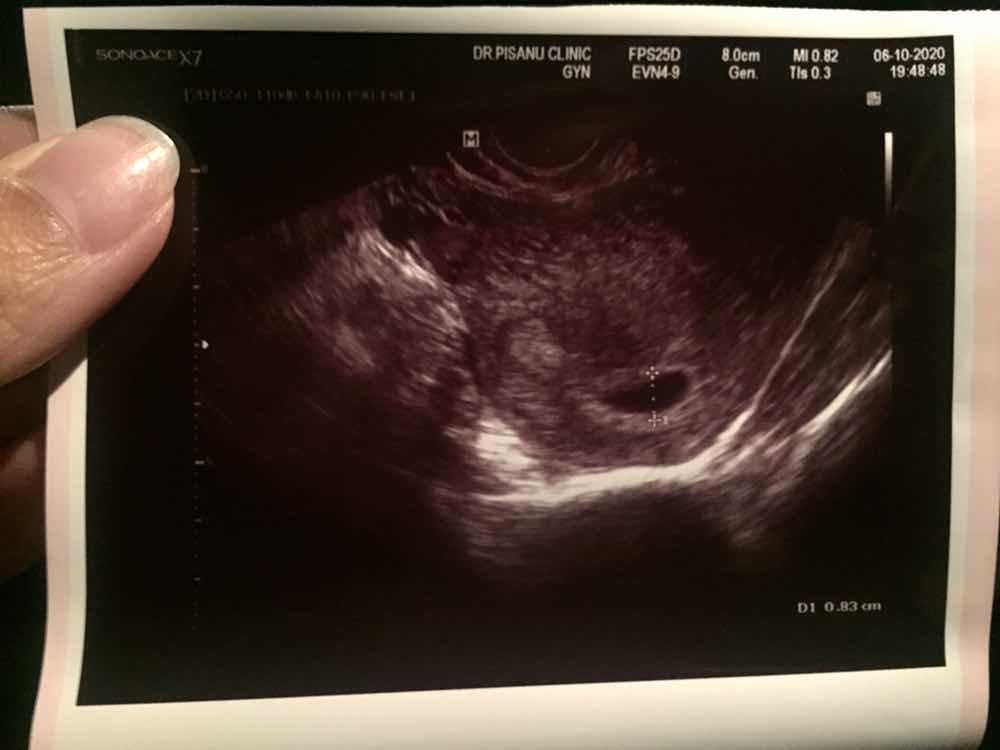 Nilalita Bowwy profile icon