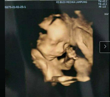 apriyanti profile icon