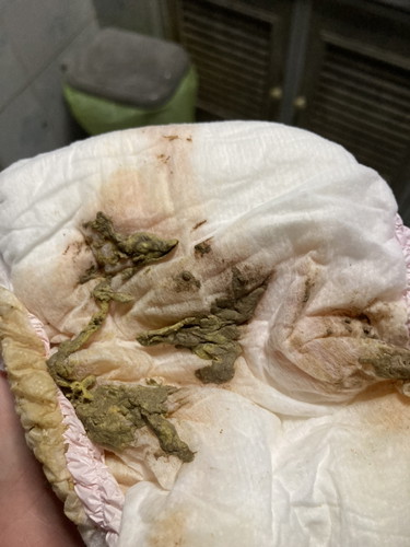 ลูกอึตรงน้ำๆเป็นสีชมพูอ่อนๆ