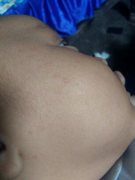 Kulit bayi