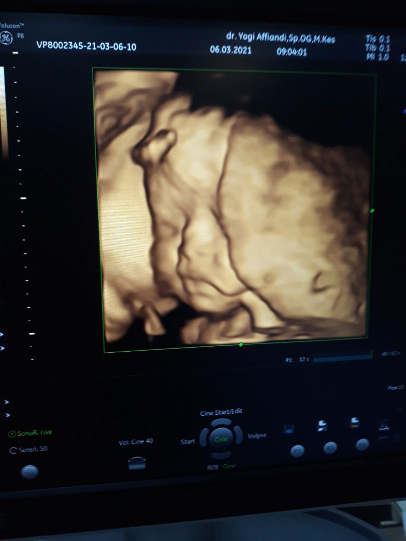 Umi Minnie profile icon