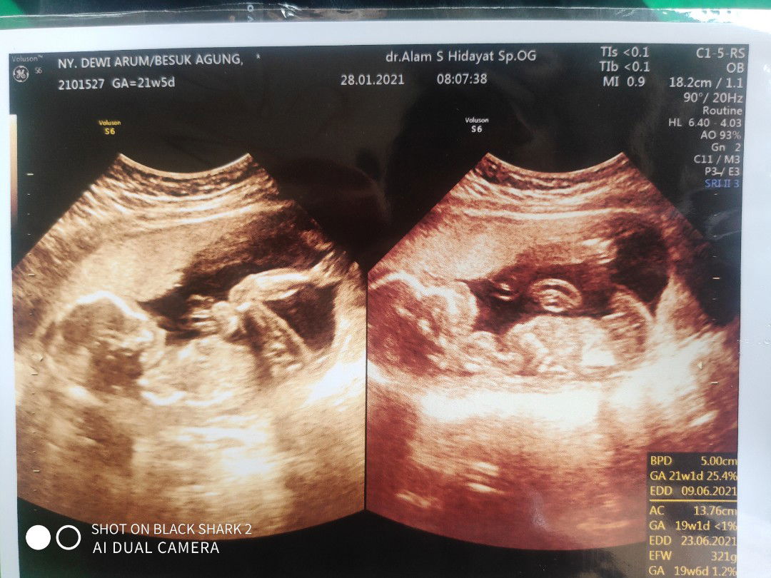 Dewi Arum Kartikasari profile icon