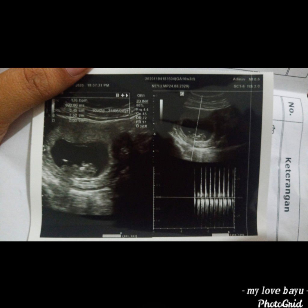 Mey Ferincees Ayu profile icon