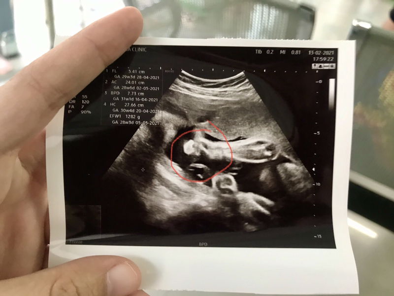 Thongta Namfon profile icon