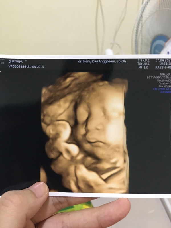 Gustriya Markhamah profile icon