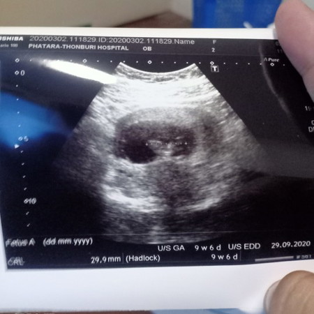 อัพเดทภาอันต้าซาวด์หน่อยค่ะ