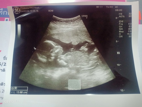19 Week