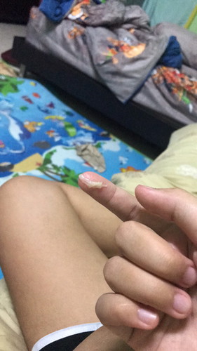 ตกขาวรึมูก