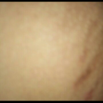 garis hitam