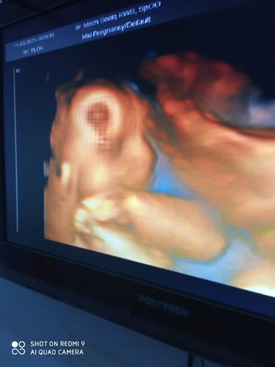 Ny.Ulva profile icon