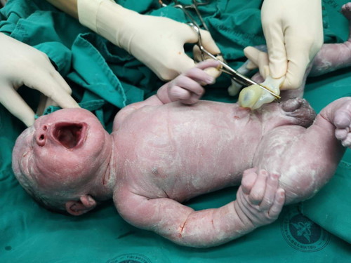 แชร์ประสบการณ์คลอดค่ะ