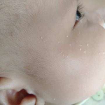 Bayi