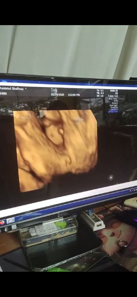 apakah agaknye gender anak sy ye??