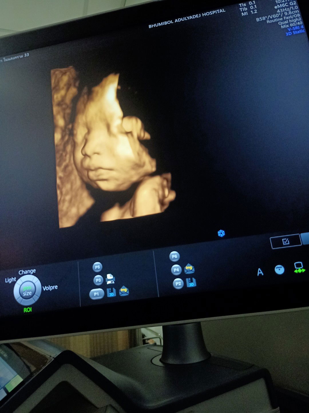 Pueng Infinityz profile icon