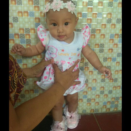 Kehamilan dalam Kondisi Sakit Hipertiroid